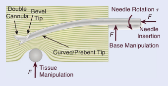 Figure 1. Several different methods of needle steering have been proposed in the literature: asymmetric-tip-based steering, base manipulation, and tissue manipulation.